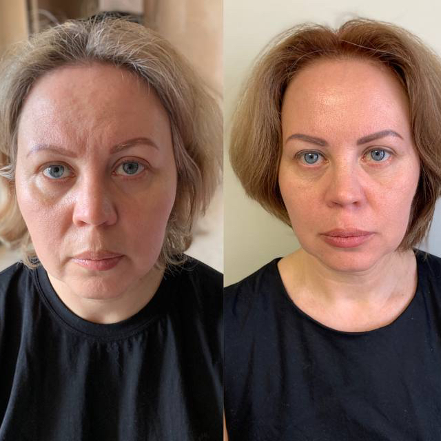 Все лицо Full Face + шея