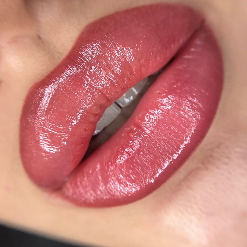 Обновление губы