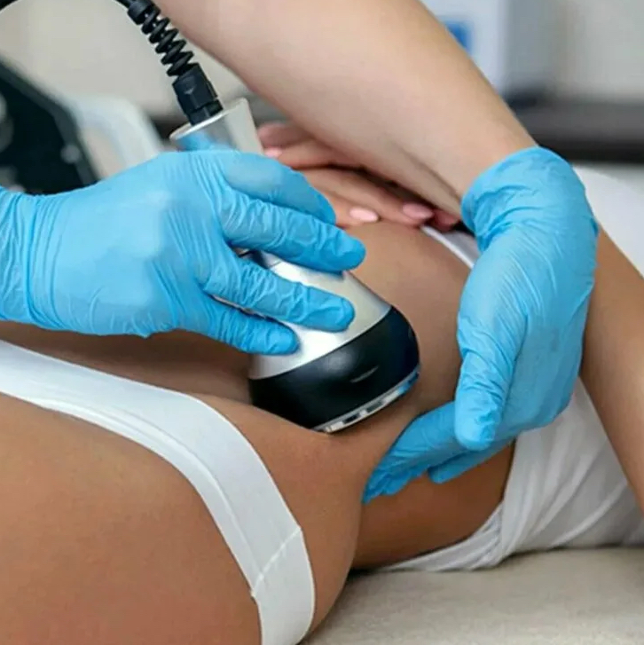 Кавитация-б/о липосакция