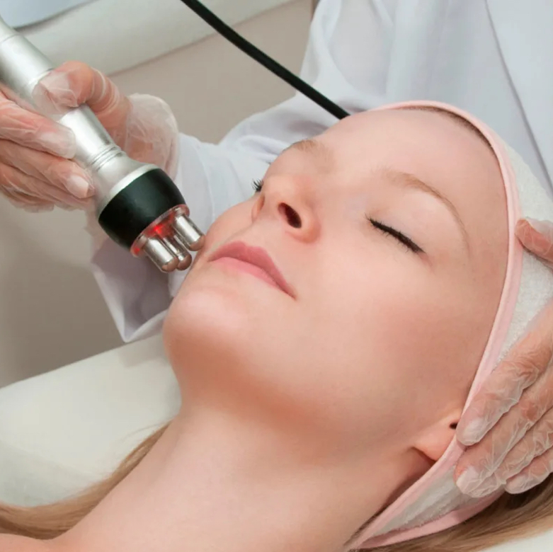 RF-лифтинг лицо