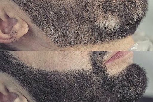 Окрашивание бороды