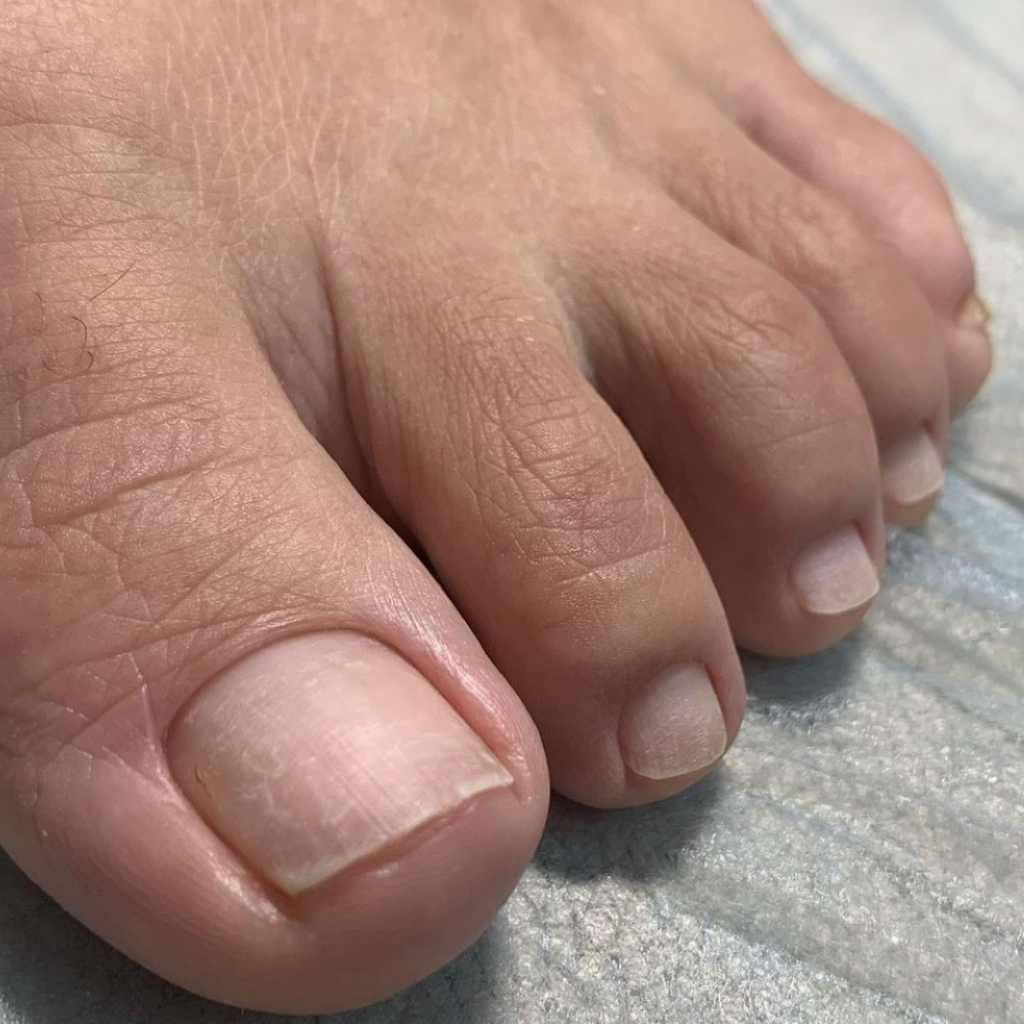 КОМПЛЕКС «ПОЛНЫЙ SMART ПЕДИКЮР БЕЗ ПОКРЫТИЯ»