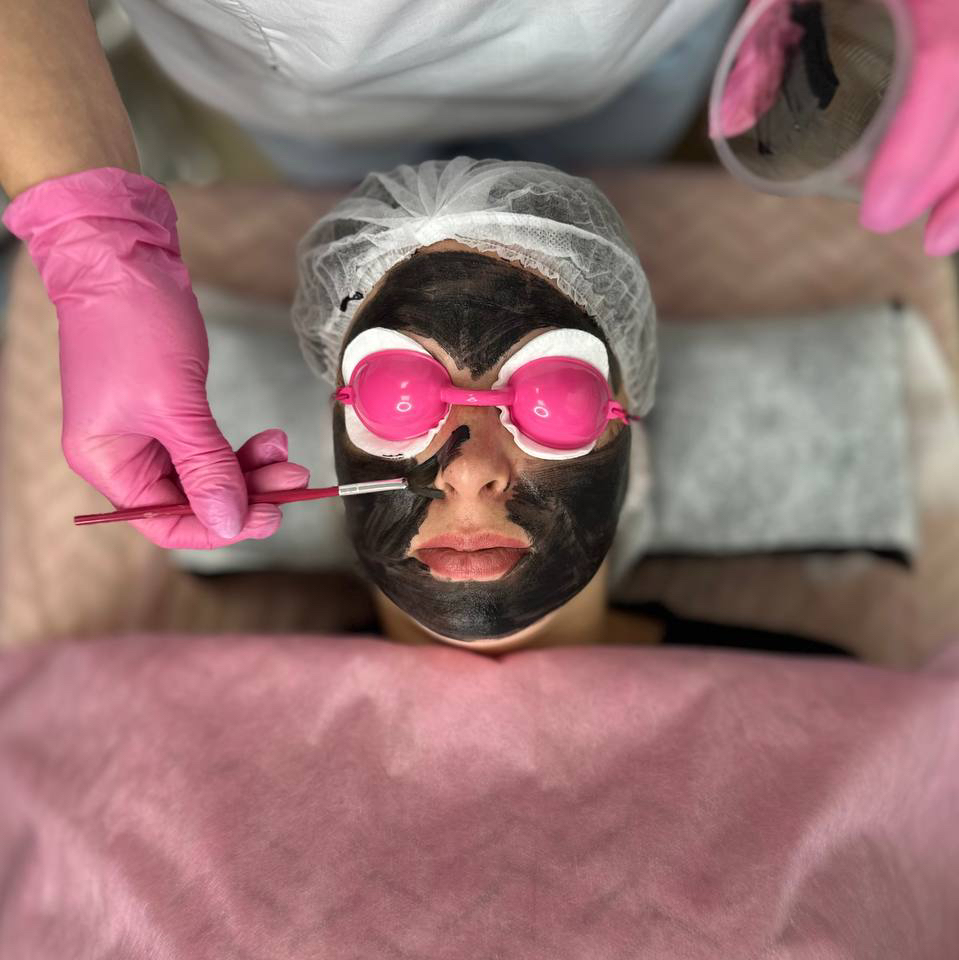 Карбоновый пилинг с наногелем LAZERTACH Лицо+Шея+Декольте