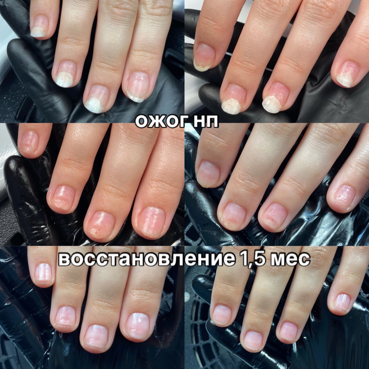 Зачистка ногтей на руках