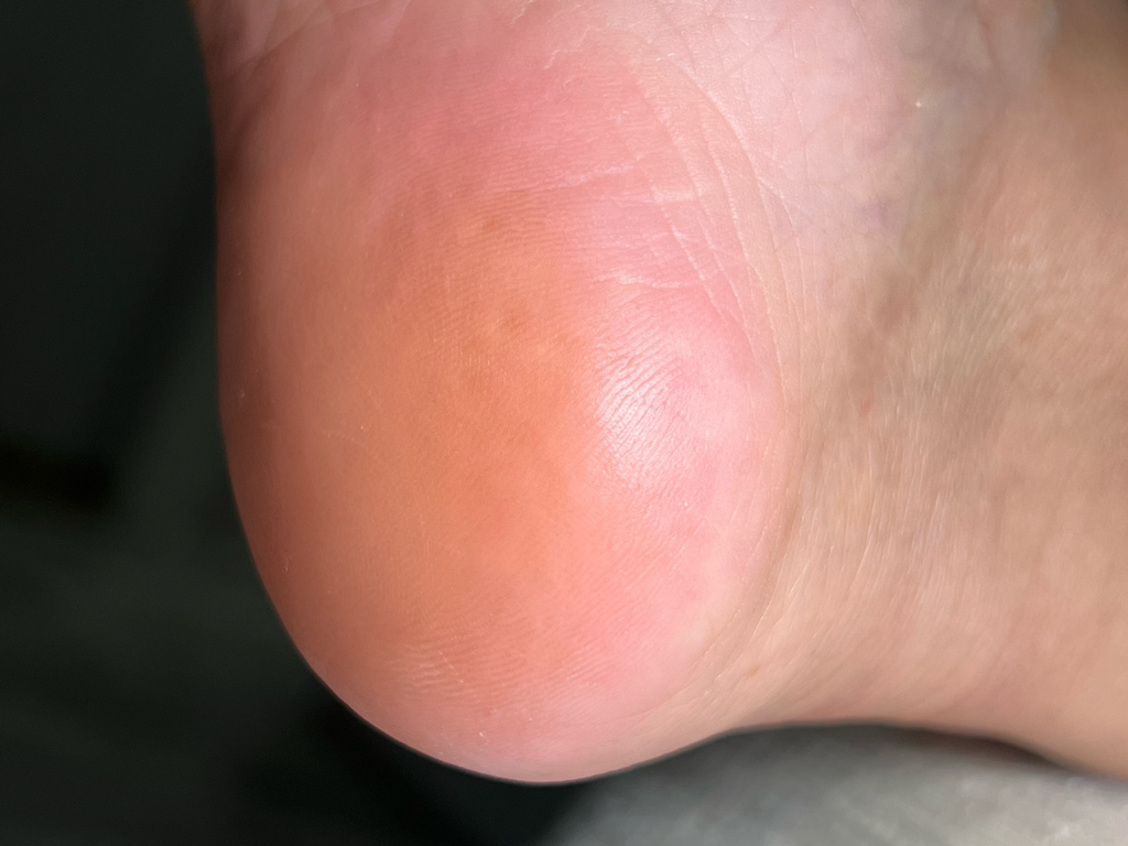 Педикюр полный(стопы и пальчики)