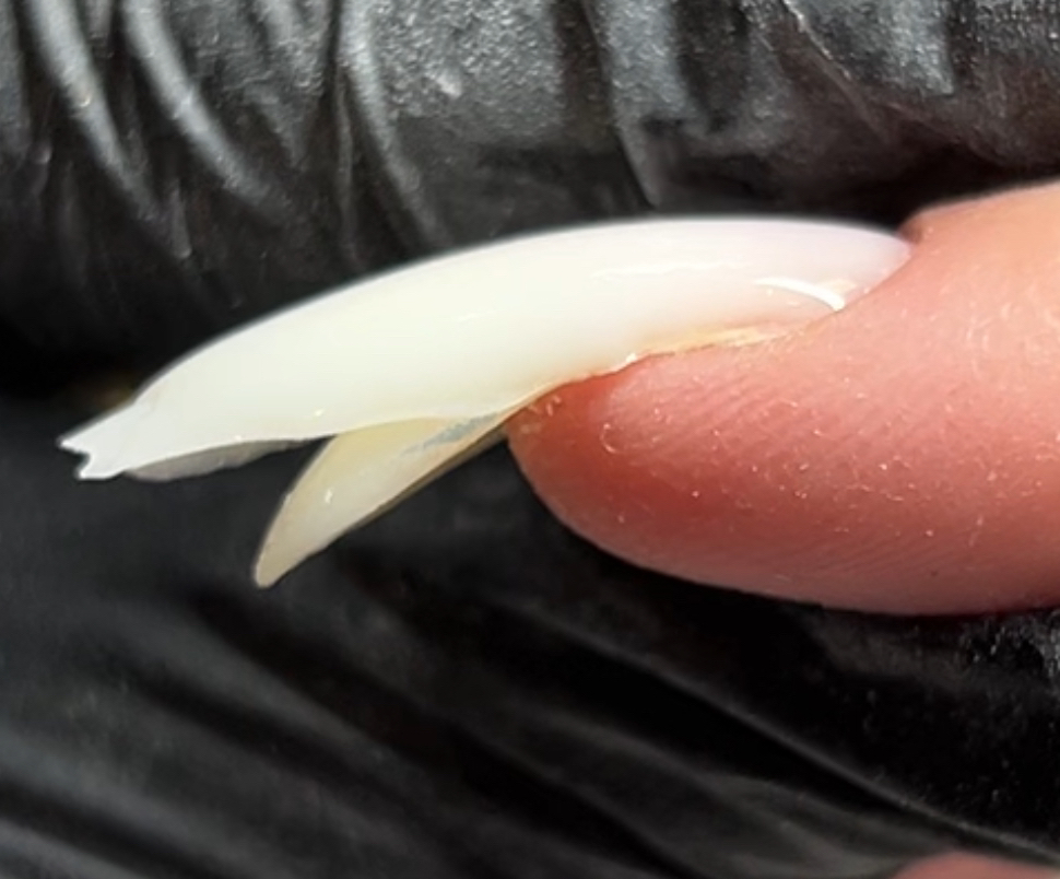 Перенаращивание ногтя (поднятие клюющего)