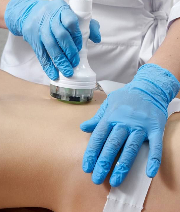 Ультразвуковой липолиз тела(кавитация), 1 зона (живот/бедра/бока)