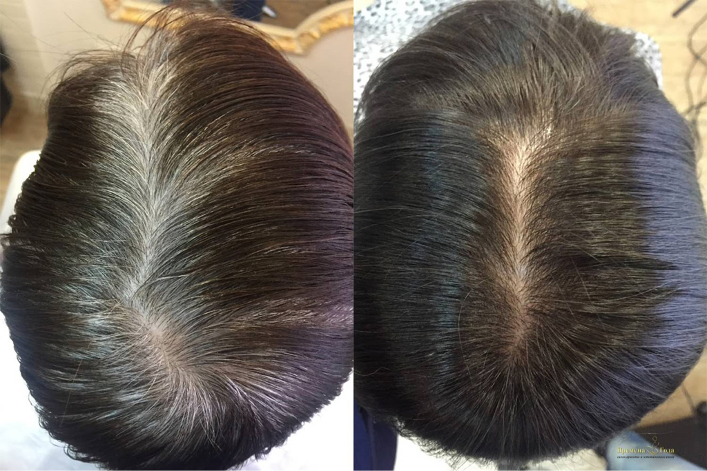 Окрашивание корней на красителе V-COLOR PROFESSIONAL