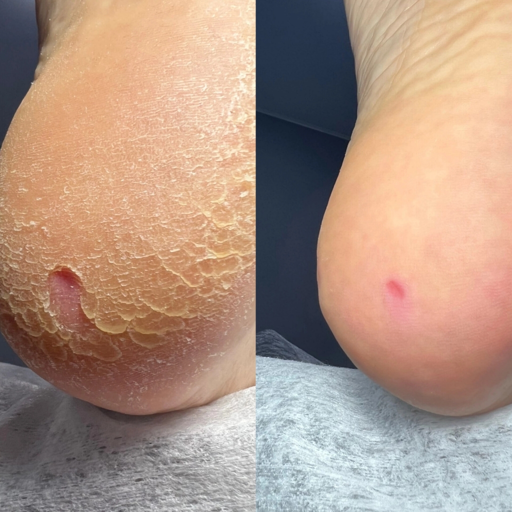 Подологический педикюр 1 категория