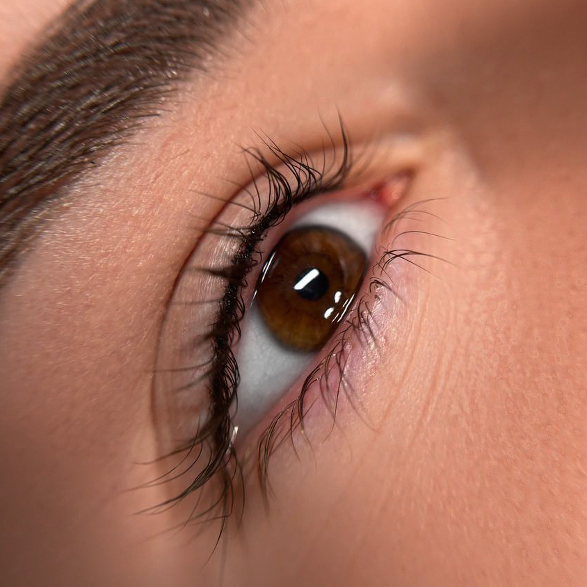 Коррекция перманентна межресничной зоны