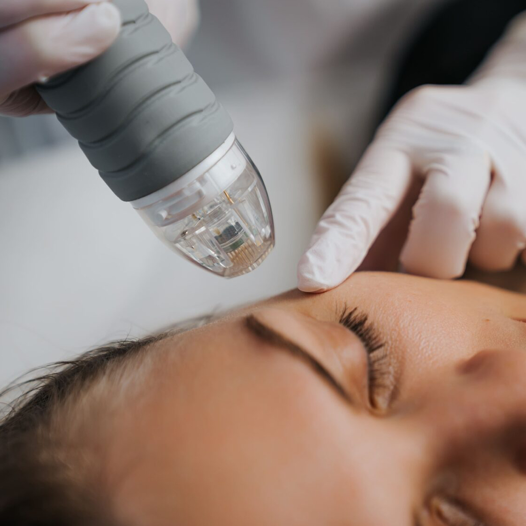 Микроигольчатый РФлифтинг