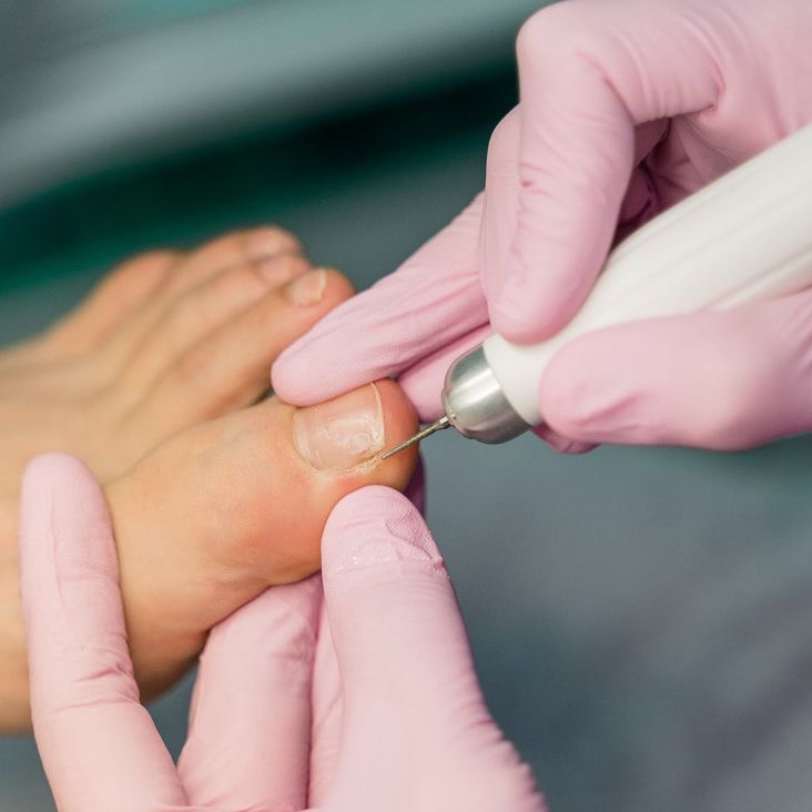 Обработка пальчиков без покрытия