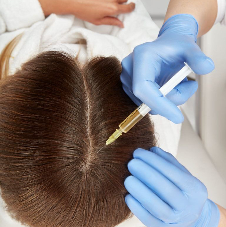 Мезотерапия волосистой части головы