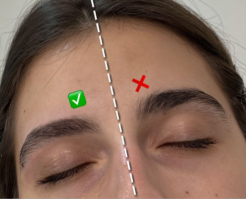 Прореживание бровей