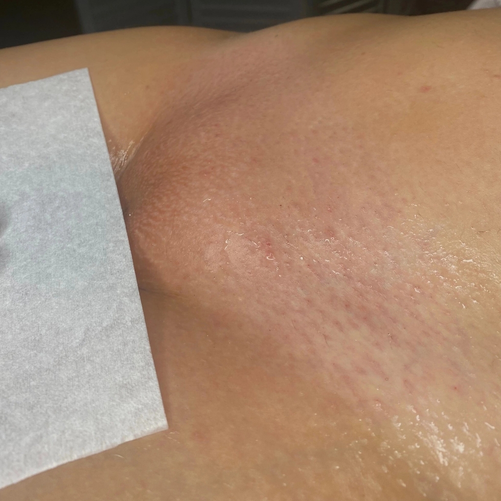 глубокое бикини