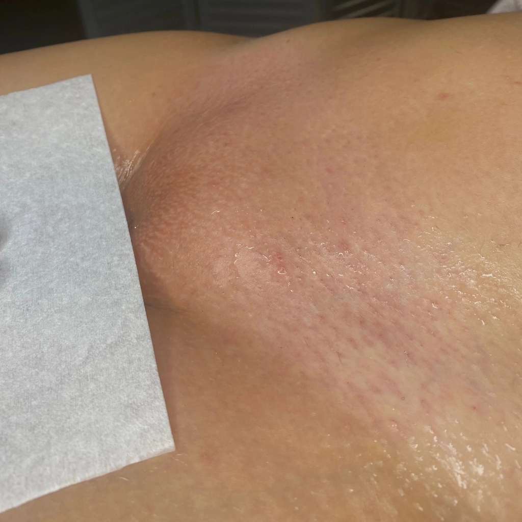 классическое бикини