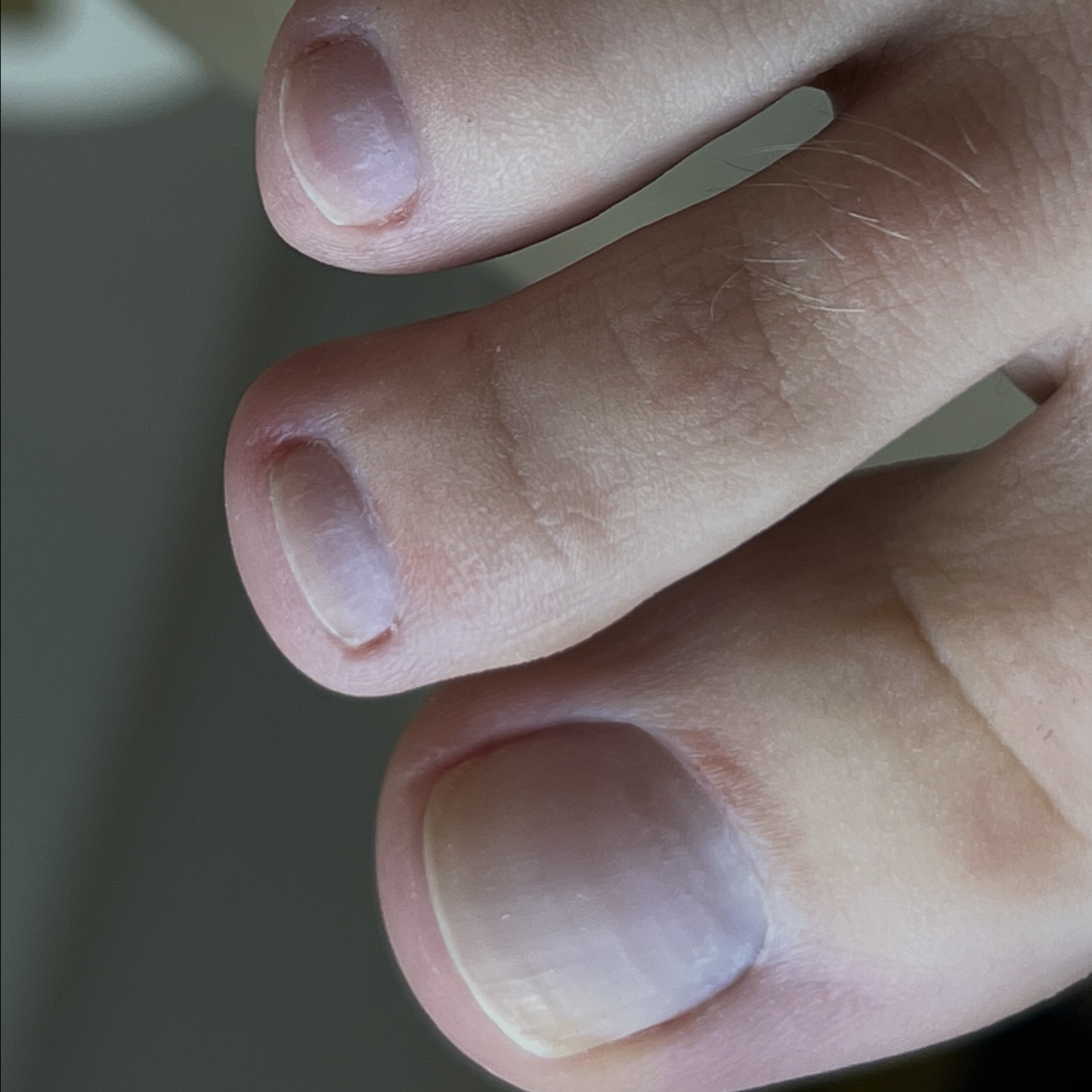 Обработка пальцев ног