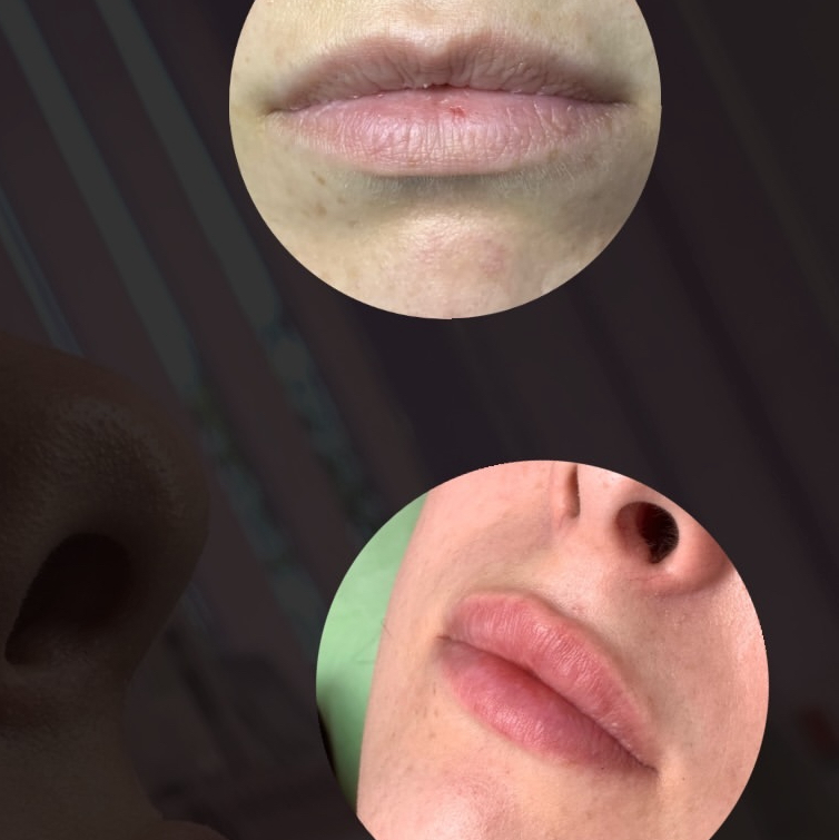 Скульптура губ