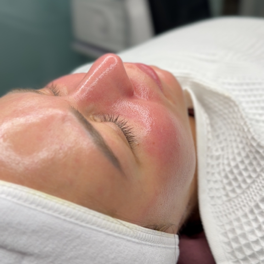 Чистка лица на Phformula