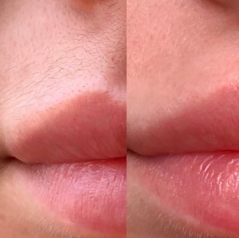 Тридинг лица