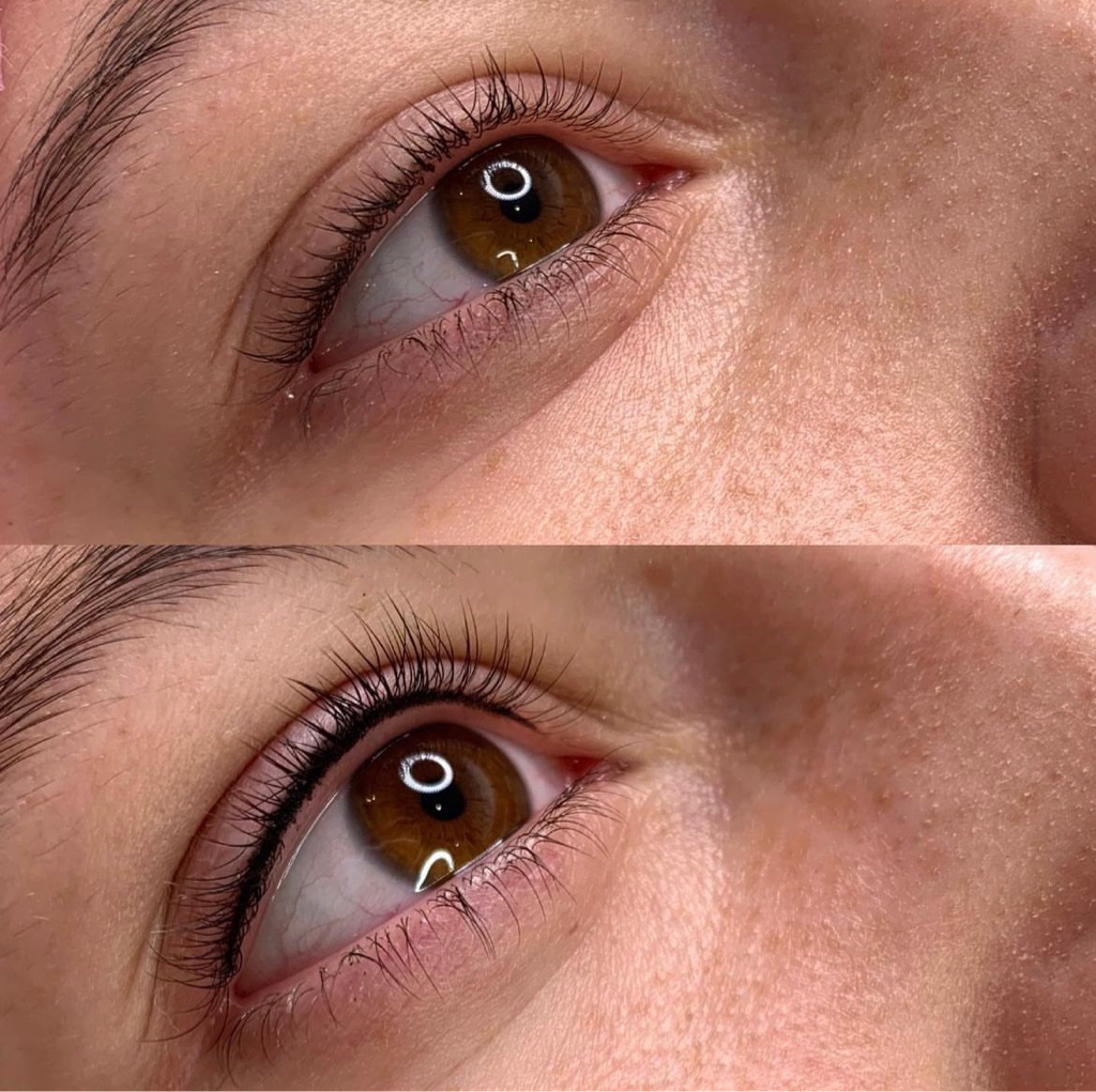 Межресничка