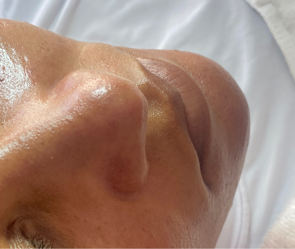 Limpieza Facial y requerimiento especial
