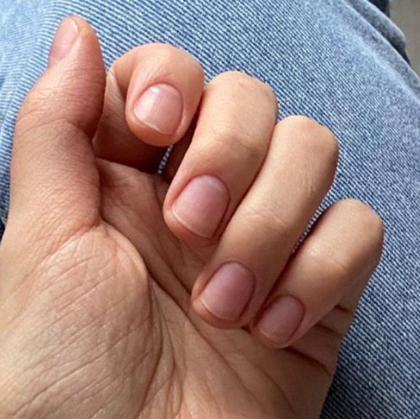 Снятие без дальнейшего покрытия (полное снятие долговременного покрытия)