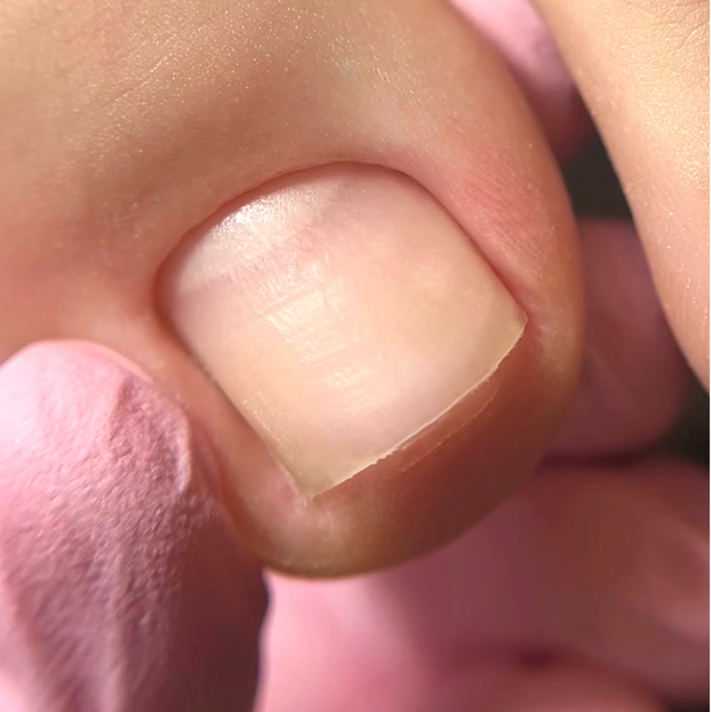 Гигиенический педикюр без обработки стоп