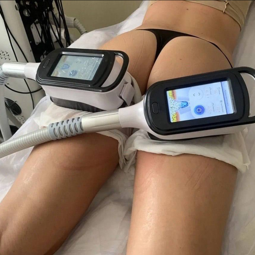 Коррекция холодом ‼️( КРИОЛИПОЛИЗ ) 1-4 манипулы