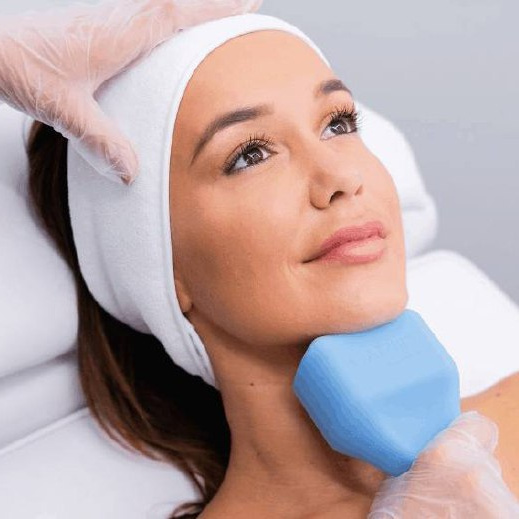 Криолиполиз Подбородок