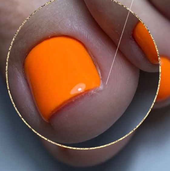 Замена тампонады