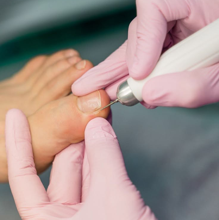 Педикюр (пальчики)