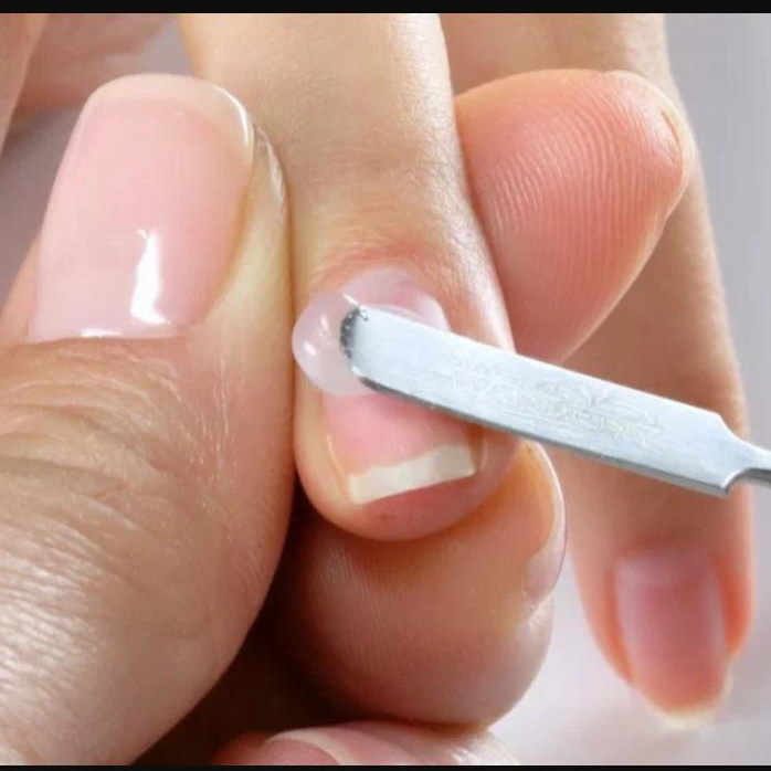 Ремонт ногтя