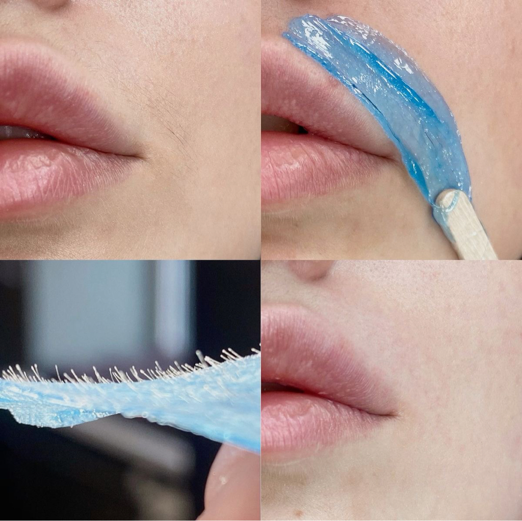 Депиляция верхней зоны губы