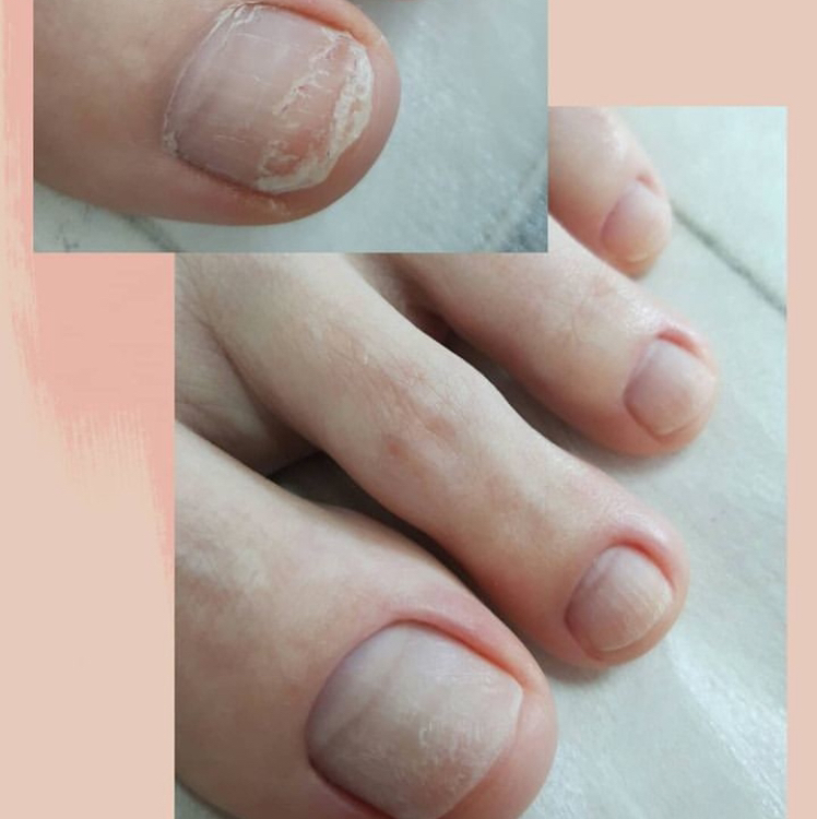 Педикюр полный с покрытием. Аппаратный или комбинированный( обработка пальчиков + обработка пяток + снятие старого материала + покрытие гель лаком )