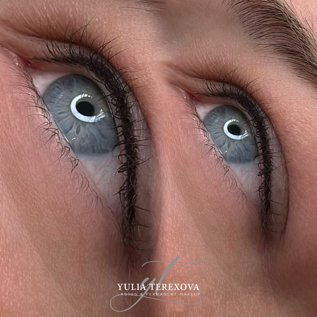 Коррекция ПМ век (межресничка)