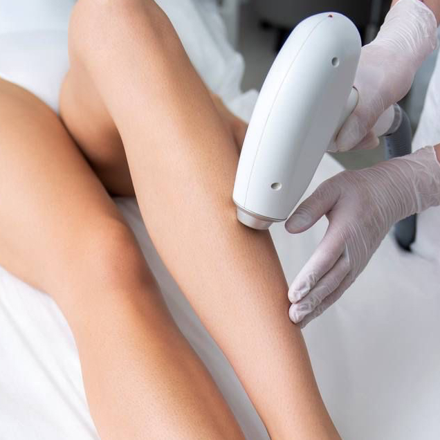 Фотоэпиляция