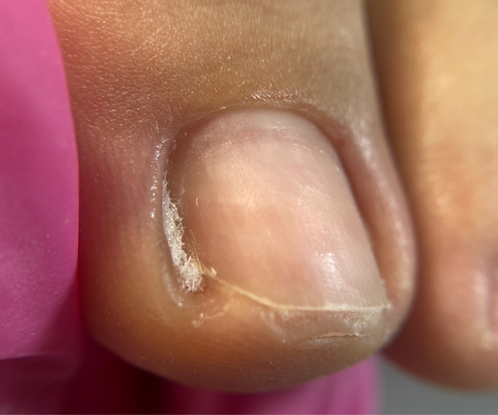 ЭСТЕТИЧЕСКИЙ ПЕДИКЮР ПАЛЬЦЫ