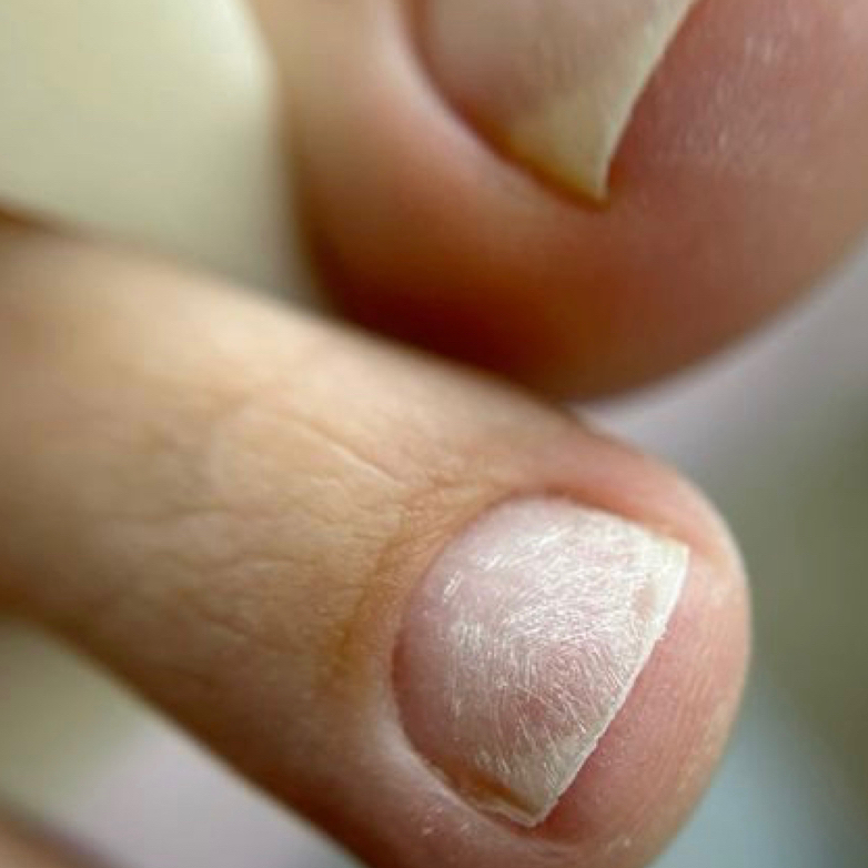 Педикюр только пальчики (без гл)/ Pedicure just toes