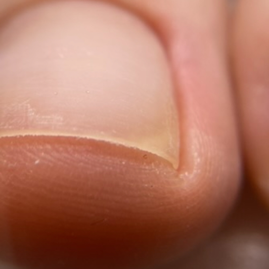 Обработка пальчиков ног+стопы