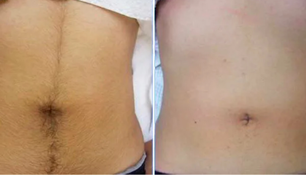 Линия живота