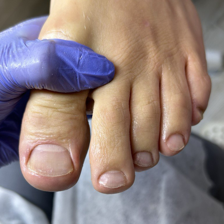 Мужской педикюр стоп и пальцев