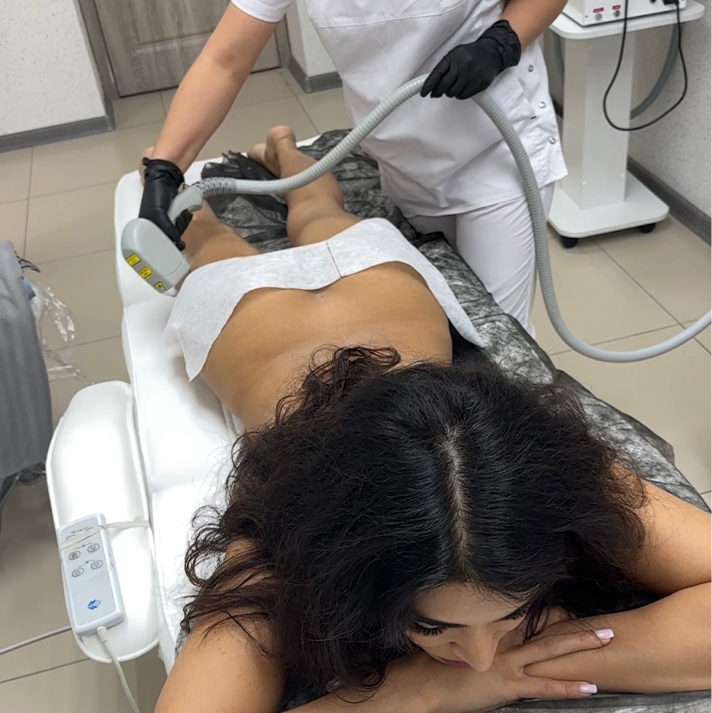 Лазерная эпиляция  Тело полностью