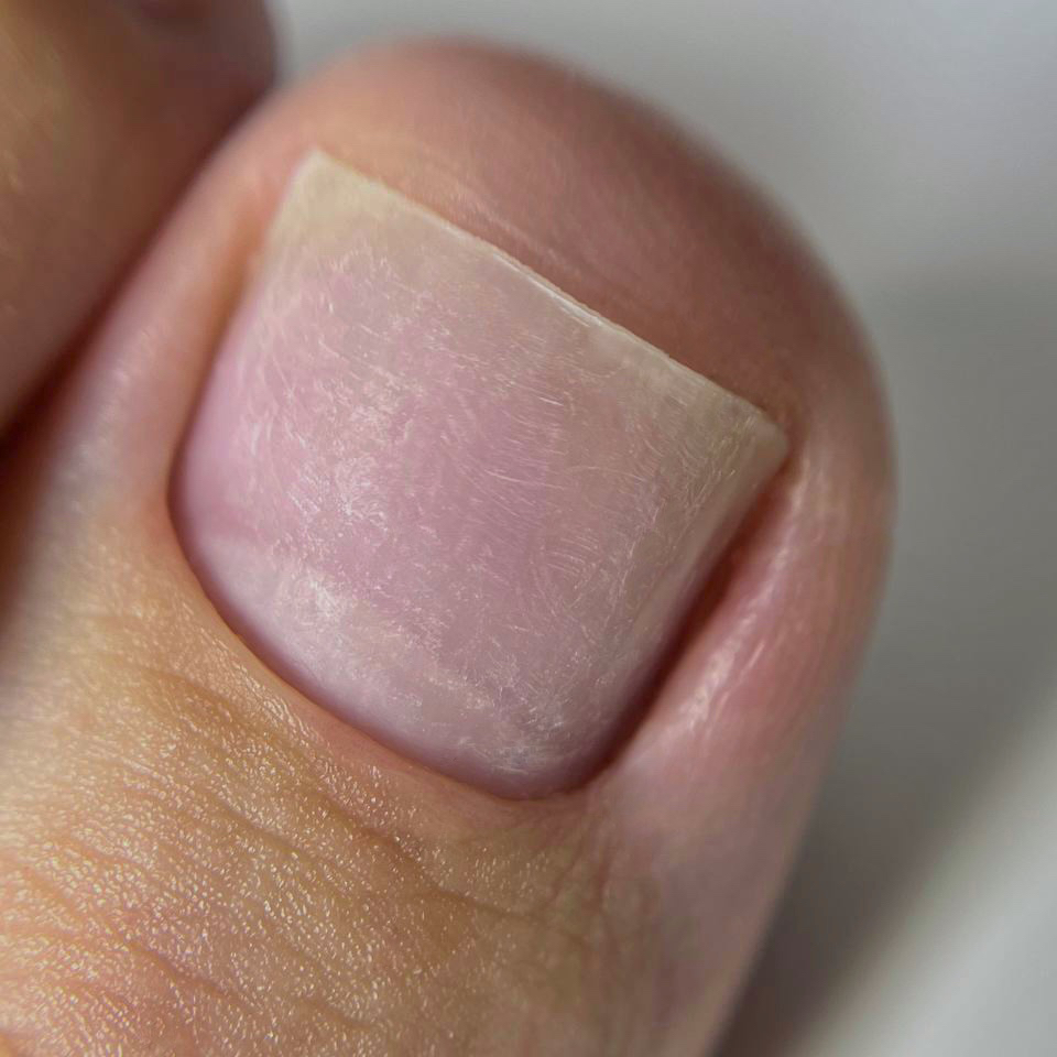 ПЕДИКЮР БЕЗ ПОКРЫТИЯ