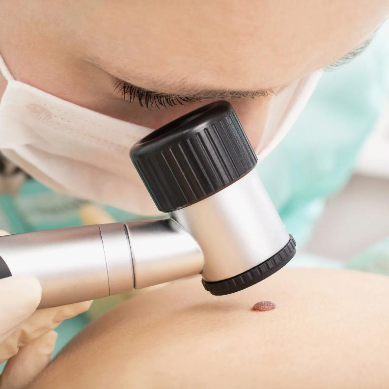 Дерматоскопия 1-5 образований