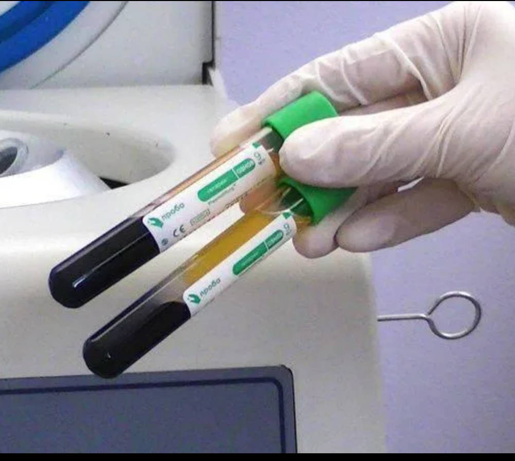 Плазмалифтинг