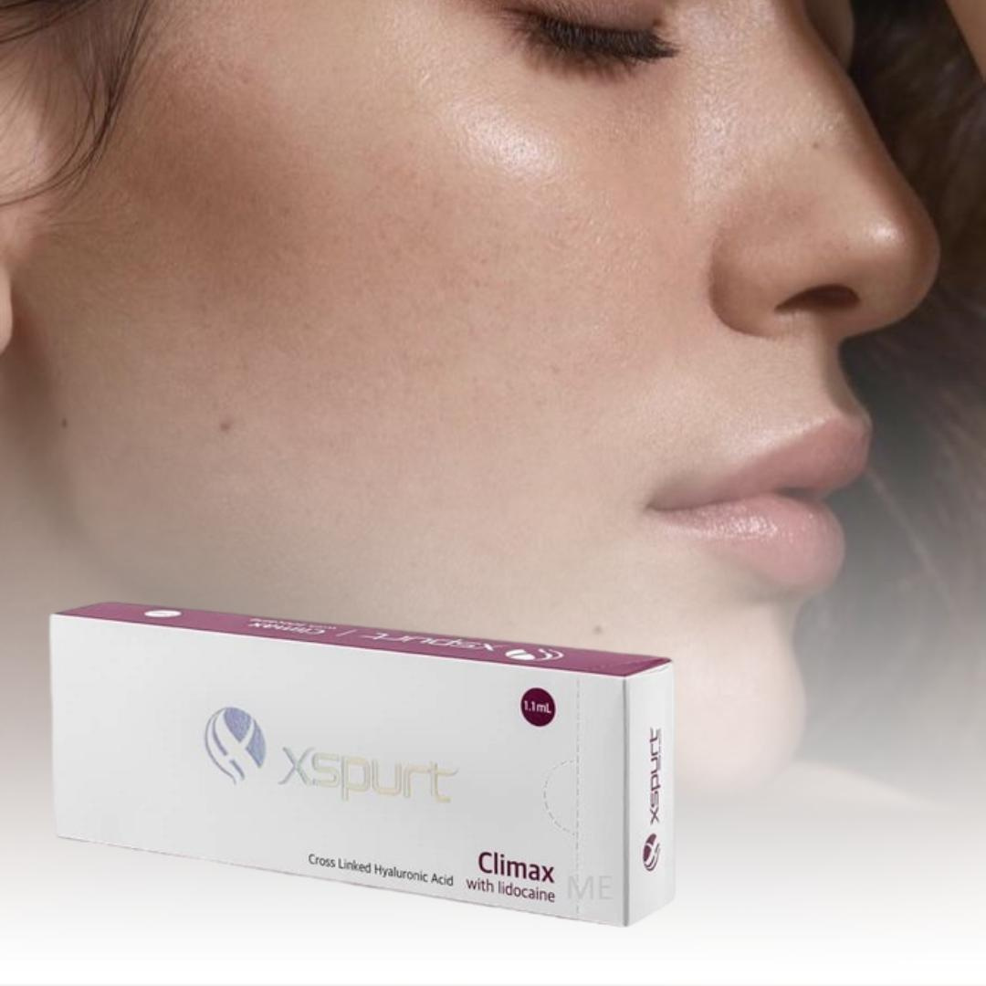 Контурная пластика скул (XSPURT Finale)