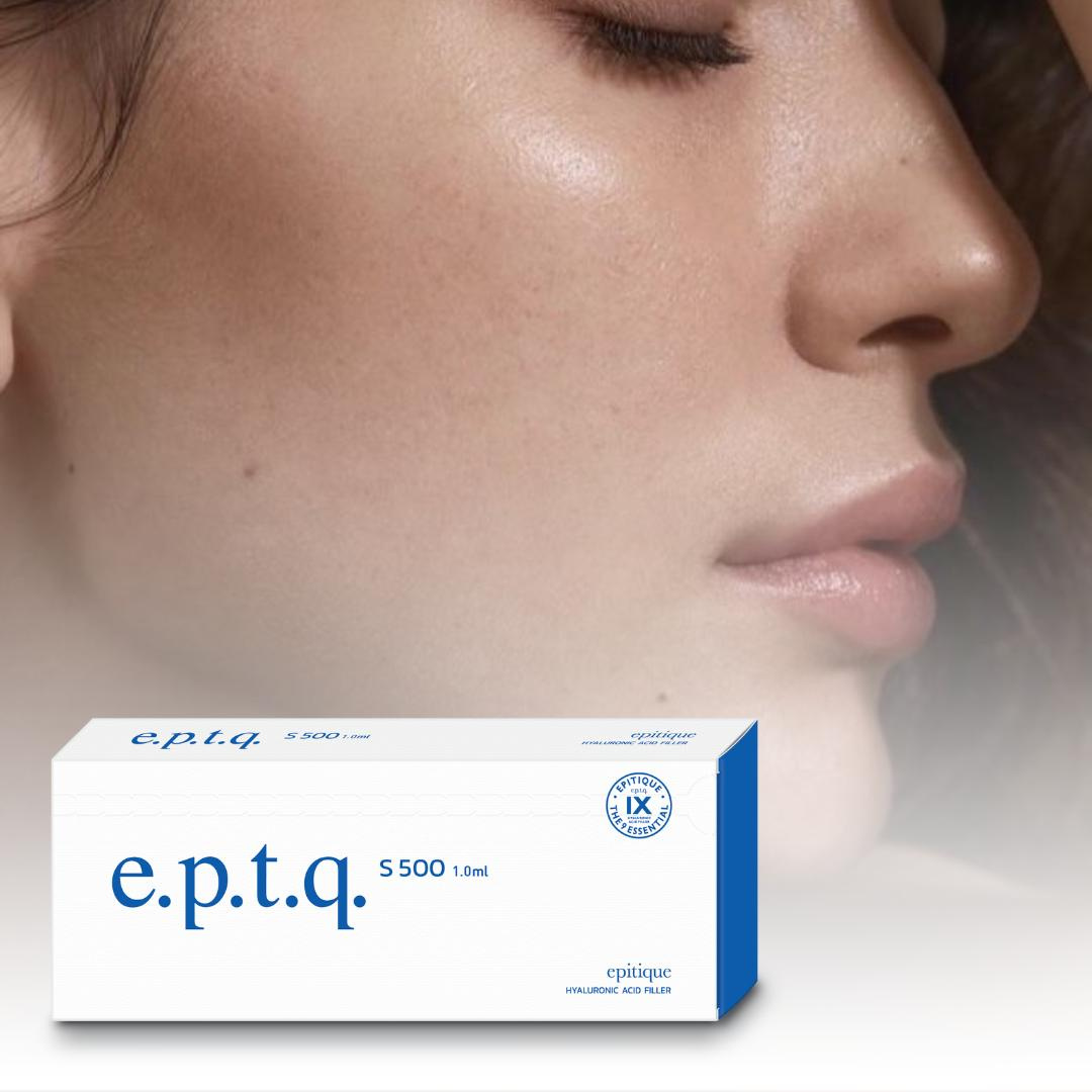 Контурная пластика скул (e.p.t.q. S500)