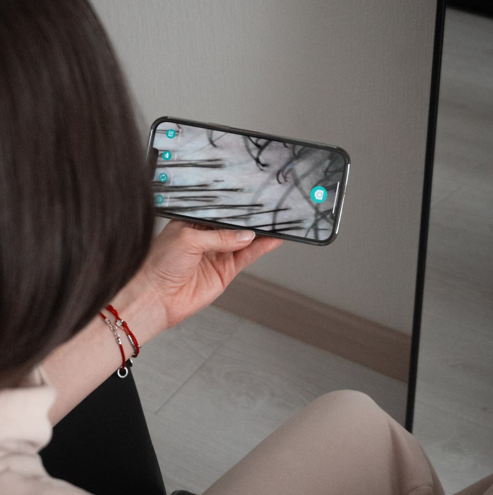 Пилинг кожи головы