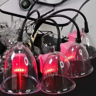 Точечный лифтинг "Паук"